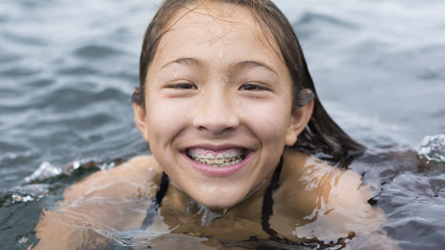 teeth spacers for kids - colgate au