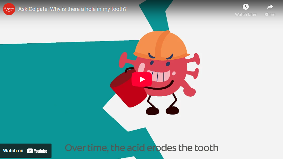 Why is there a hole in my tooth video