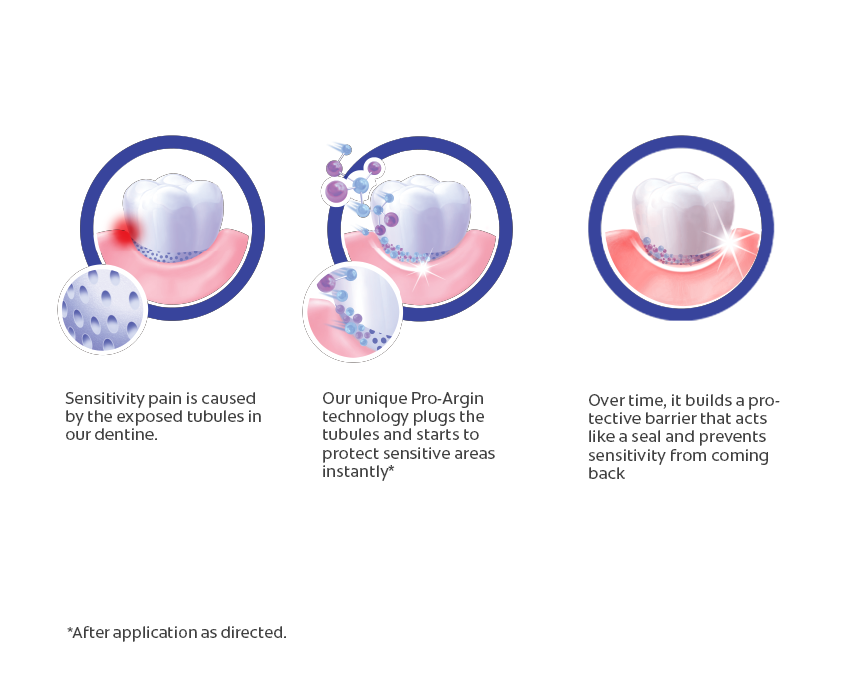 Colgate Sensitive Pro-Relief variants